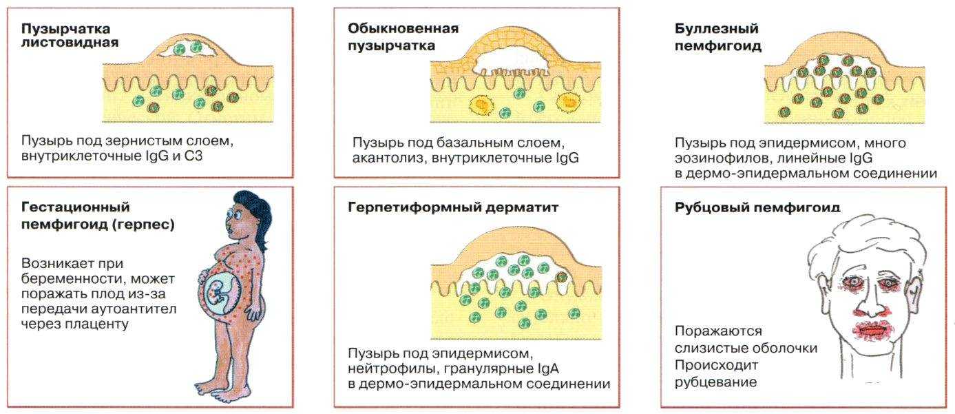 К чему снится сыпь