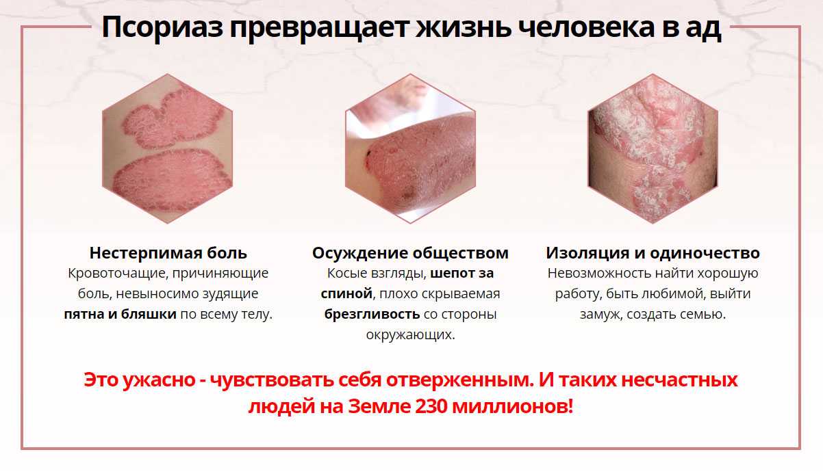 К чему снится сыпь, сонник – сыпь во сне