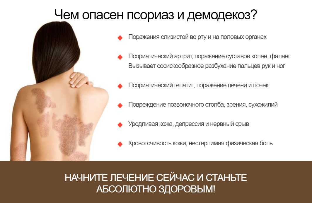 Сонник сыпь на теле: лице, руках во сне красная видеть к чему снится?