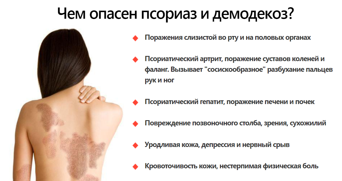 К чему снится кожа - значение сна кожа по соннику