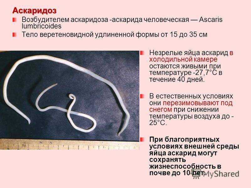 К чему снятся глисты: расшивровка по сонникам