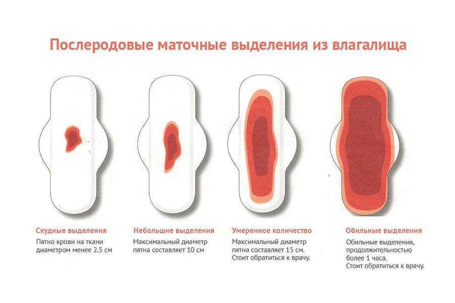 К чему может присниться менструальная кровь