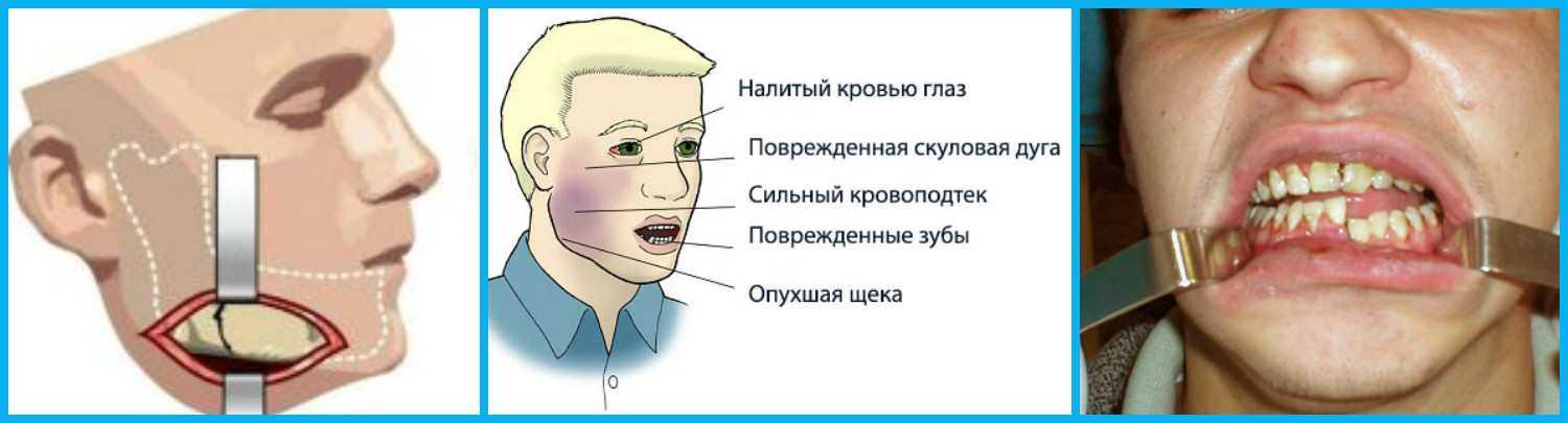 К чему снится флюс на щеке или зубе — 36 толкований из разных сонников