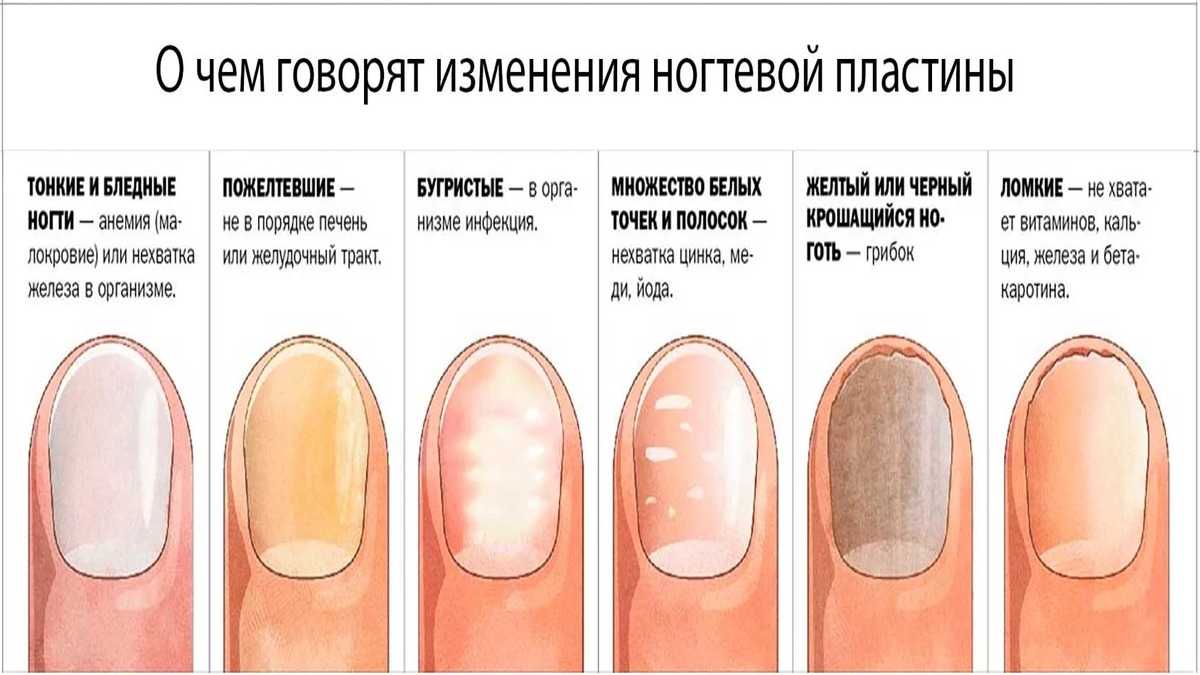 К чему снятся  ногти во сне — по 90 сонникам! если видишь во сне ногти что значит?