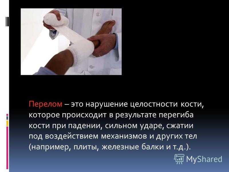 К чему приснилась сломанная рука