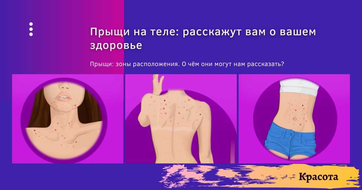 Сонник к чему снится аллергия на лице
