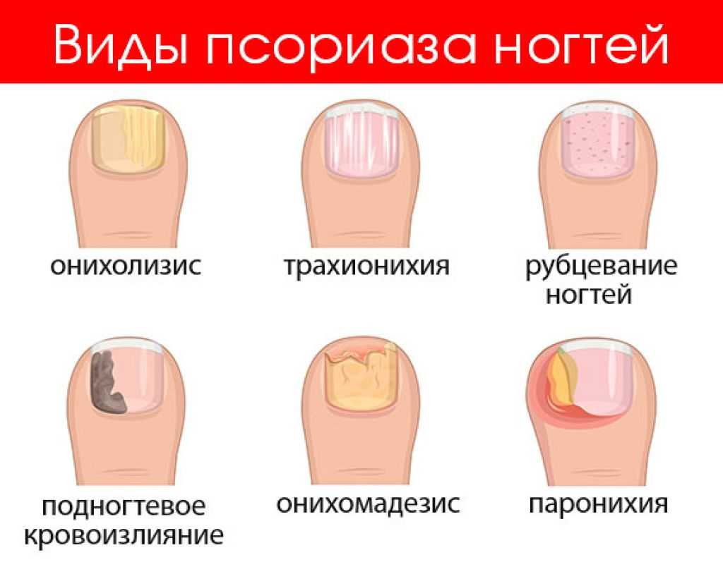 К чему снится сломанный ноготь: толкование образа по сонникам