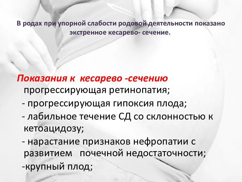К чему снятся роды кесарево