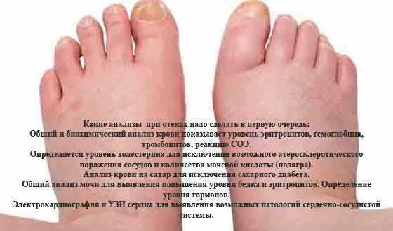Сонник промочить ноги: к чему снится и что означает сон?