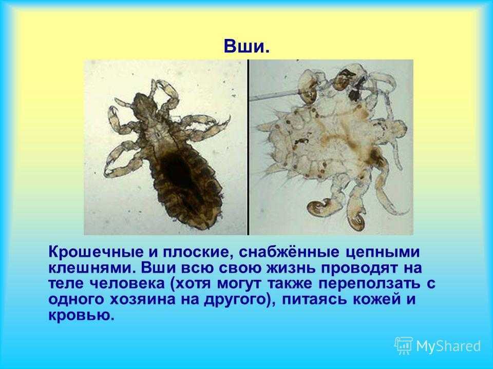 К чему снятся вши - значение сна вши по соннику