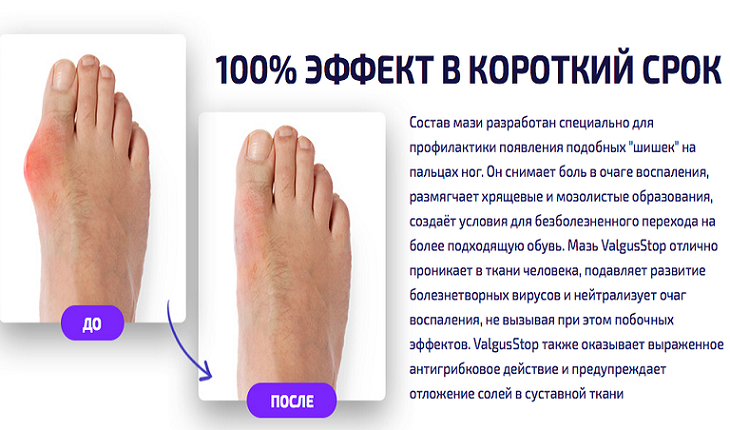 К чему снится ноги: толкование сна — мир космоса