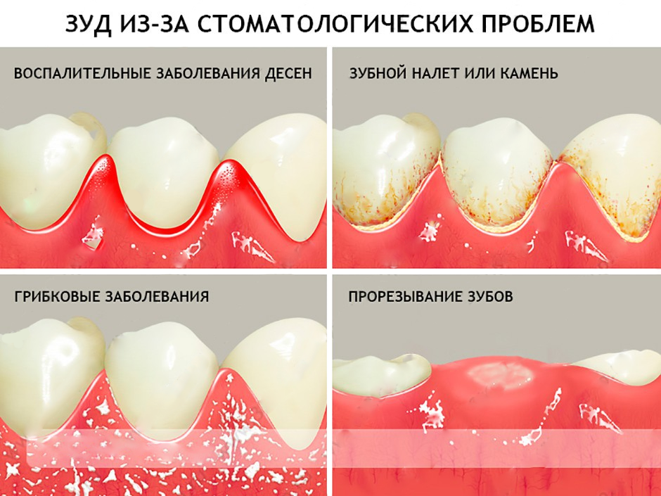 К чему снится флюс на щеке