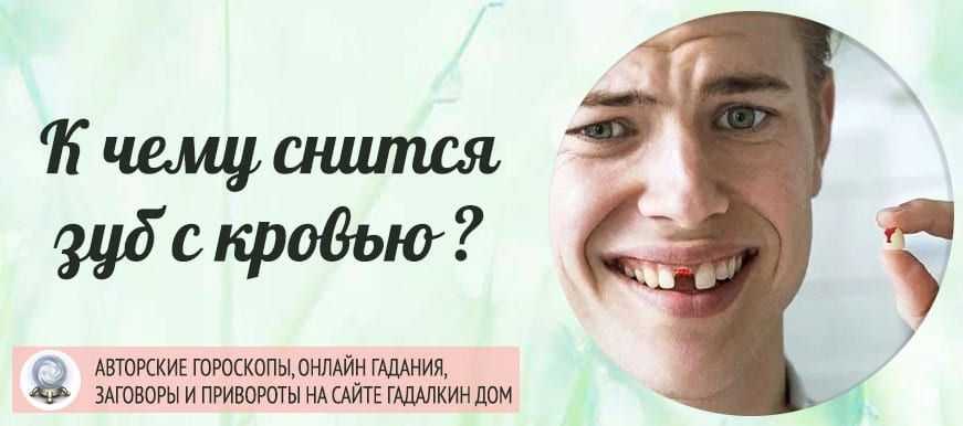 К чему снятся гнилые зубы: толкование по различным сонникам