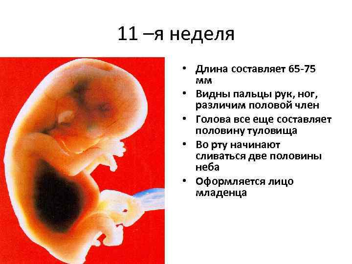 Как трактовать сон о зародыше — 40 точных значений по разным сонникам