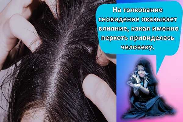 К чему снится  перхоть во сне — по 90 сонникам! если видишь во сне перхоть что значит?