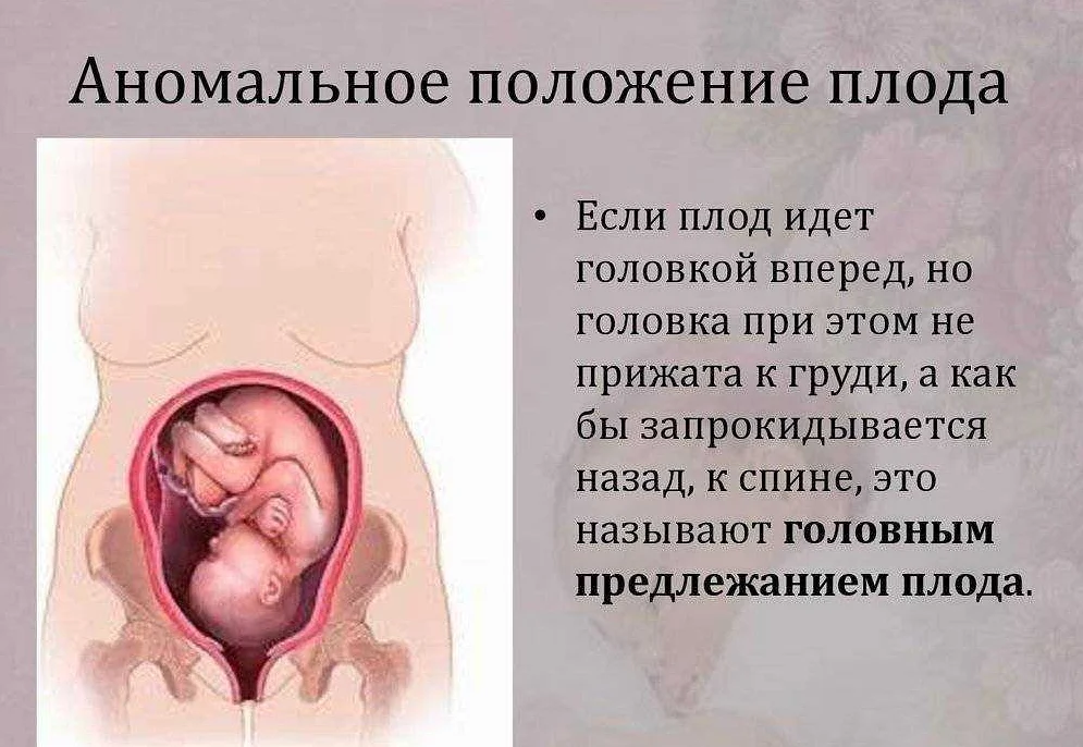 К чему снится беременность и шевеление ребенка? толкование по 33 сонникам