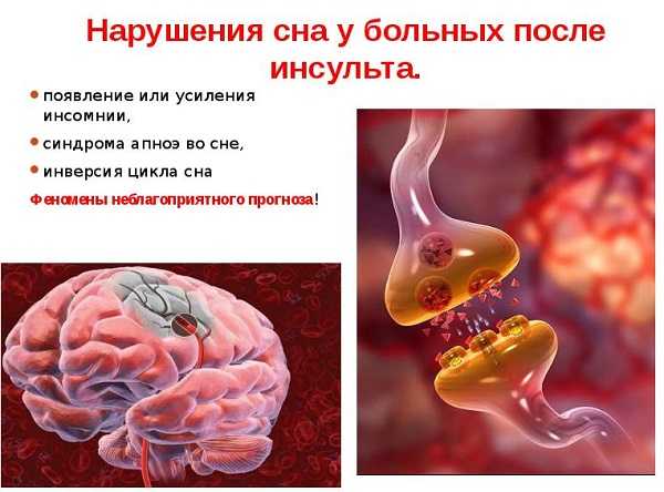 К чему снятся больные люди? значение и толкование сна - tolksnov.ru