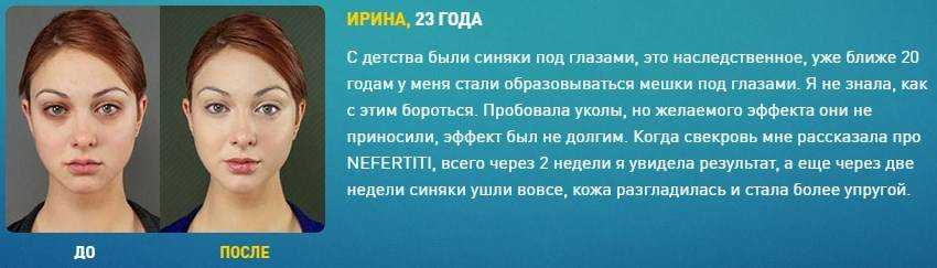 Синяк на руке и ноге