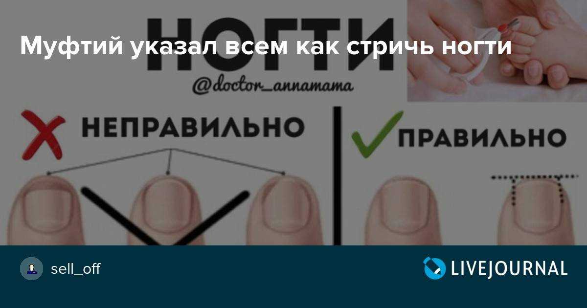 К чему снятся ногти