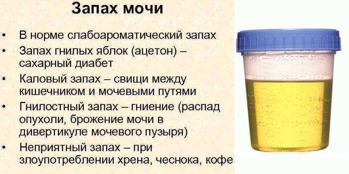 К чему снится много мочи. «сонник моча приснилась, к чему снится во сне моча