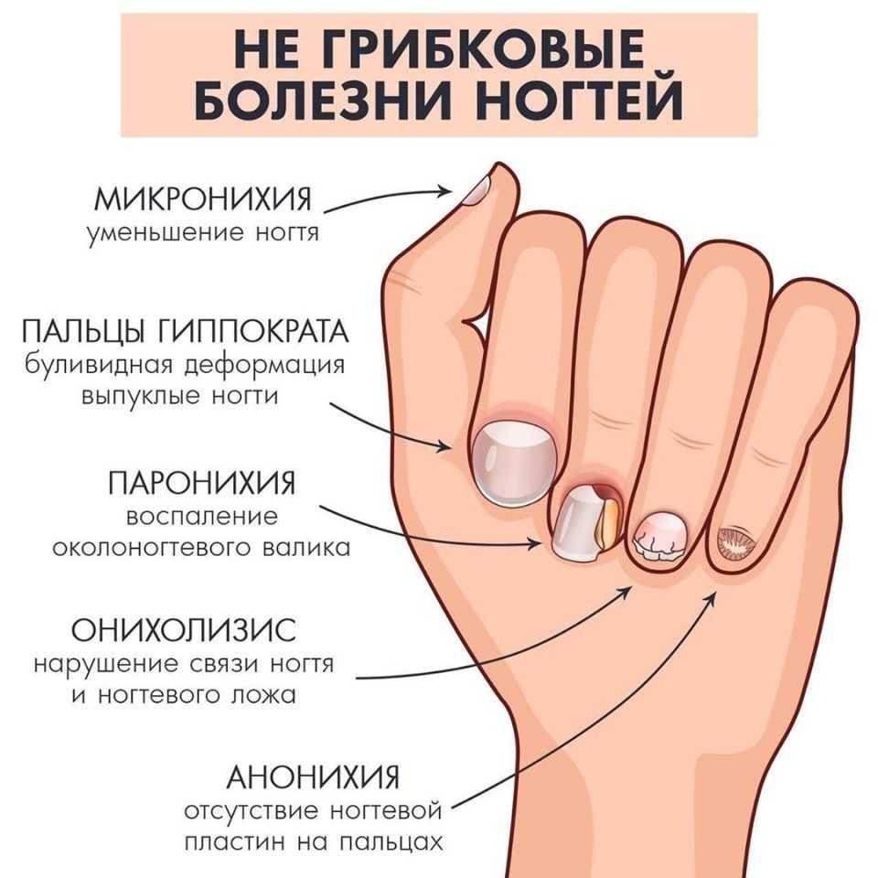 К чему снятся длинные ногти на руках – значение по соннику для женщин и мужчин