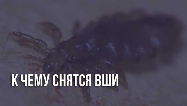 К чему снятся  вши во сне — по 90 сонникам! если видишь во сне вши что значит?