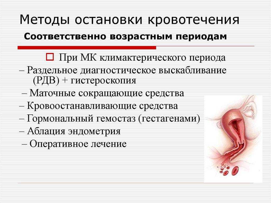 Как растолковать, к чему снится кровотечение при беременности