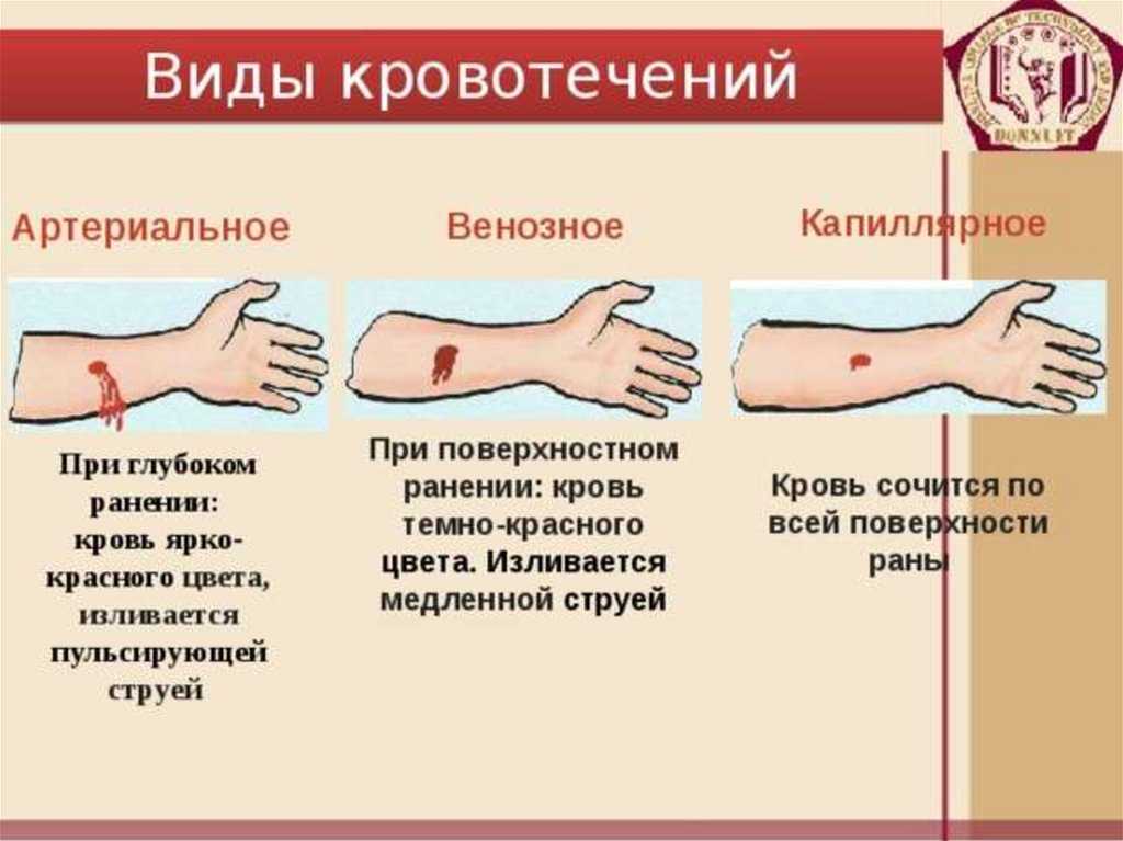 Сонник вены: трактовка сновидения в популярных сонниках