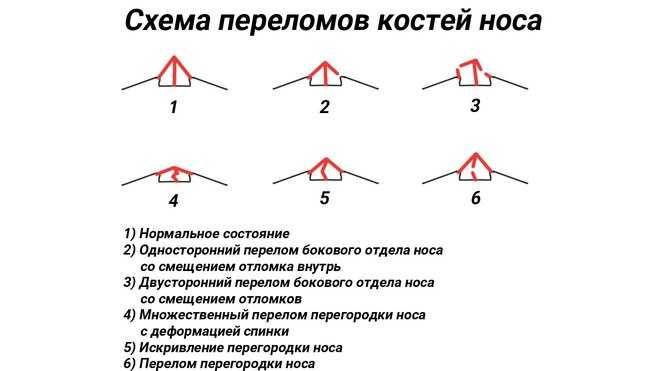 Сон: нос