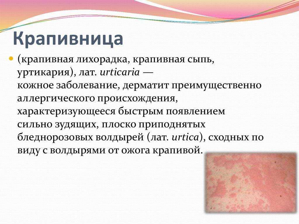 Сонник сыпь на теле лице, руках во сне красная видеть к чему снится