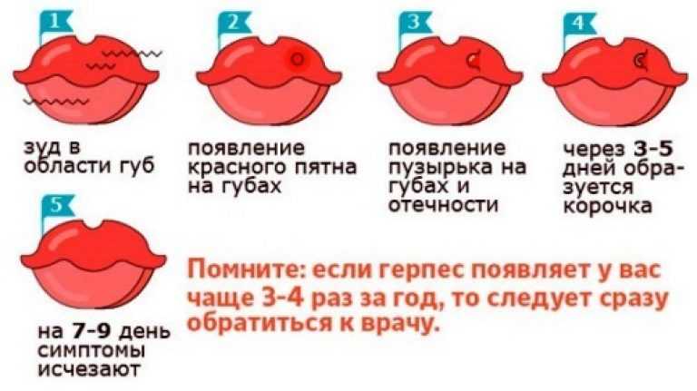 Сонник герпес