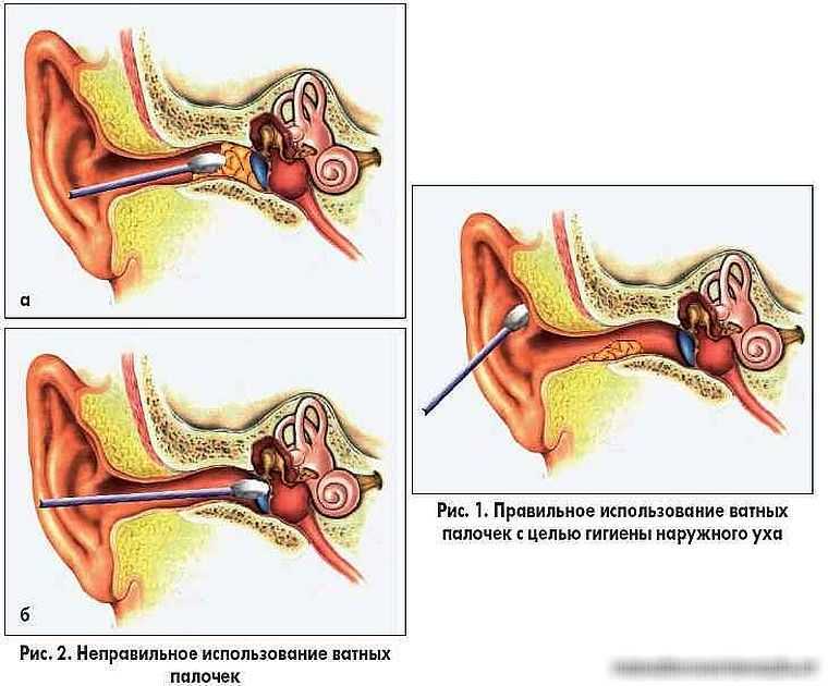 К чему снится грязные от серы уши свои или чужие