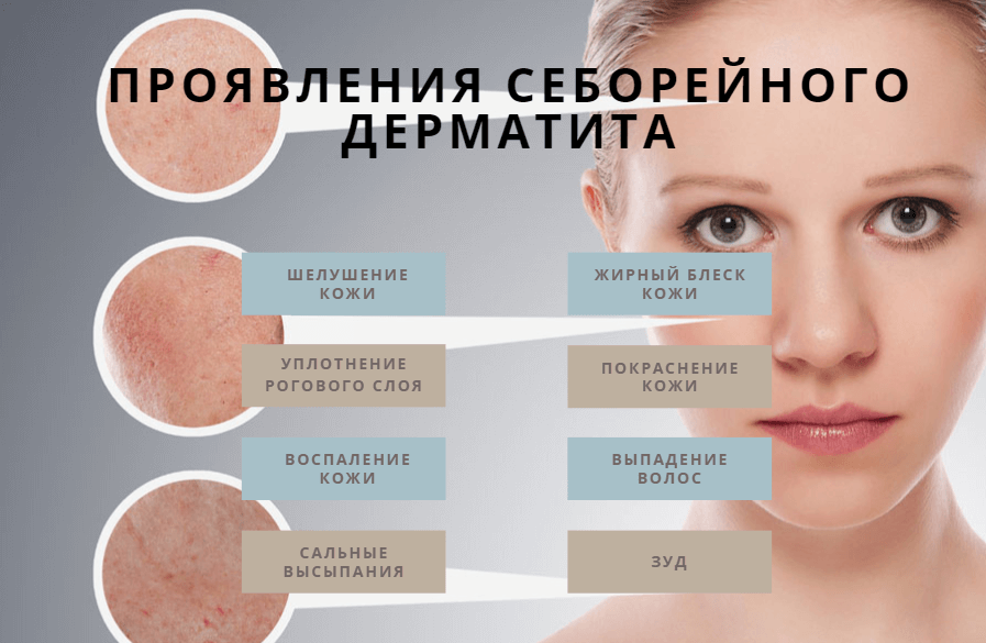 Как расшифровать сон о сыпи на теле — 30 значений