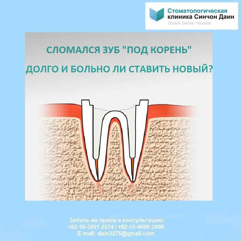 Приснилось вырвать зуб – толкование сна по сонникам