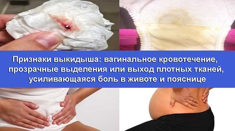 «беременность к чему снится во сне? если видишь во сне беременность, что значит?»